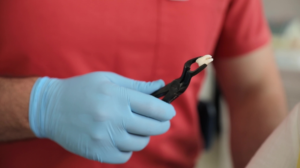 five signs you might need a tooth pulled